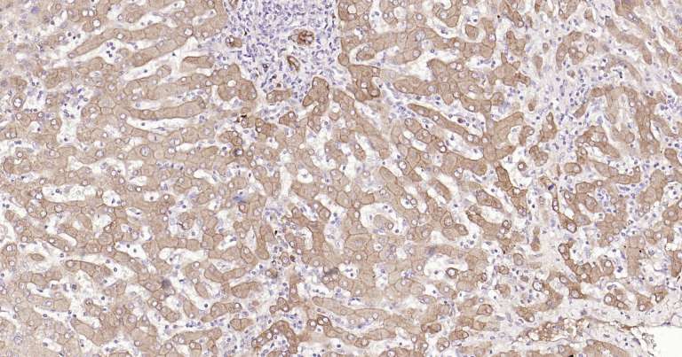 Human CK18 Ready-To-Use IHC Kit (免疫组化试剂盒) | Bioss